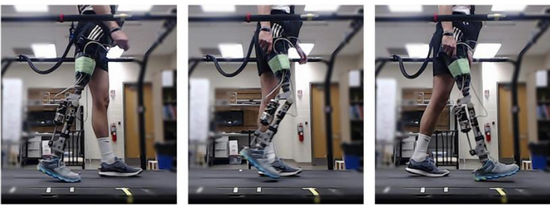 利用VR技术 帮助患者和医生更方便地安装假肢